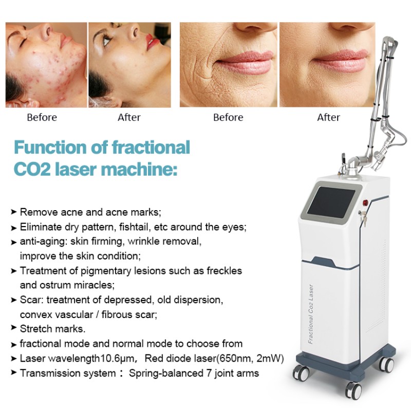 Best Quality Laser 10600nm Fraccionado Co2 Laser Machine Co2 Fractional Laser Beauty Machine