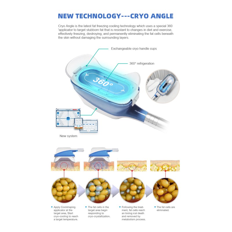 2025 Hot Sales Cryo360 Machine Cryo Cool  Fat Freezing Slimming Machine for Face Lip Nose Feet Target Areas