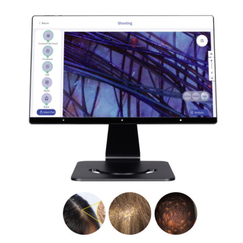 Hair Scalp Machine Hair Scalp Analyzer