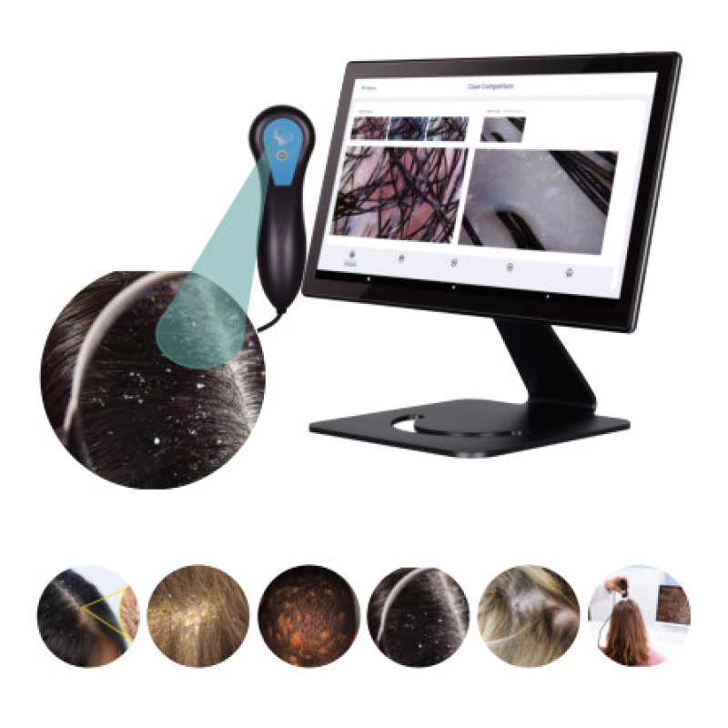 2025  Hair Scalp Analyzer Hair Scalp Machine for Beauty Salon