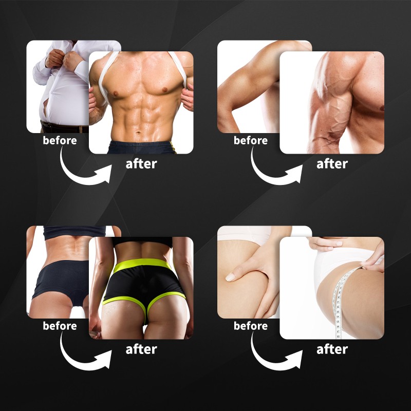 7 Tesla Portable  Neo  2/4 Handle Emt Machine Ems Muscle Stimulator Body Sculpting Machine Rf