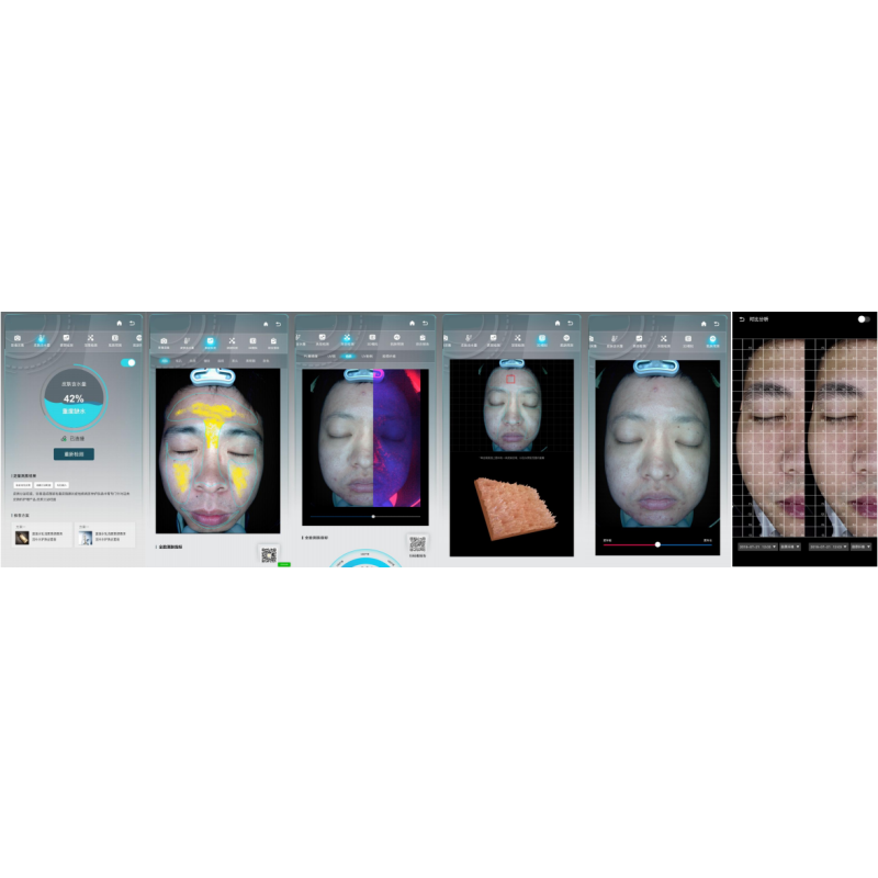 2025 Factory Wholesale Price Skin Analyzer Machine for Beauty Salon Spa