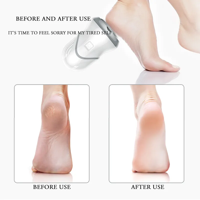 Removers Personal Care Rechargeable Foot File Callus Remover Electric Pedicure