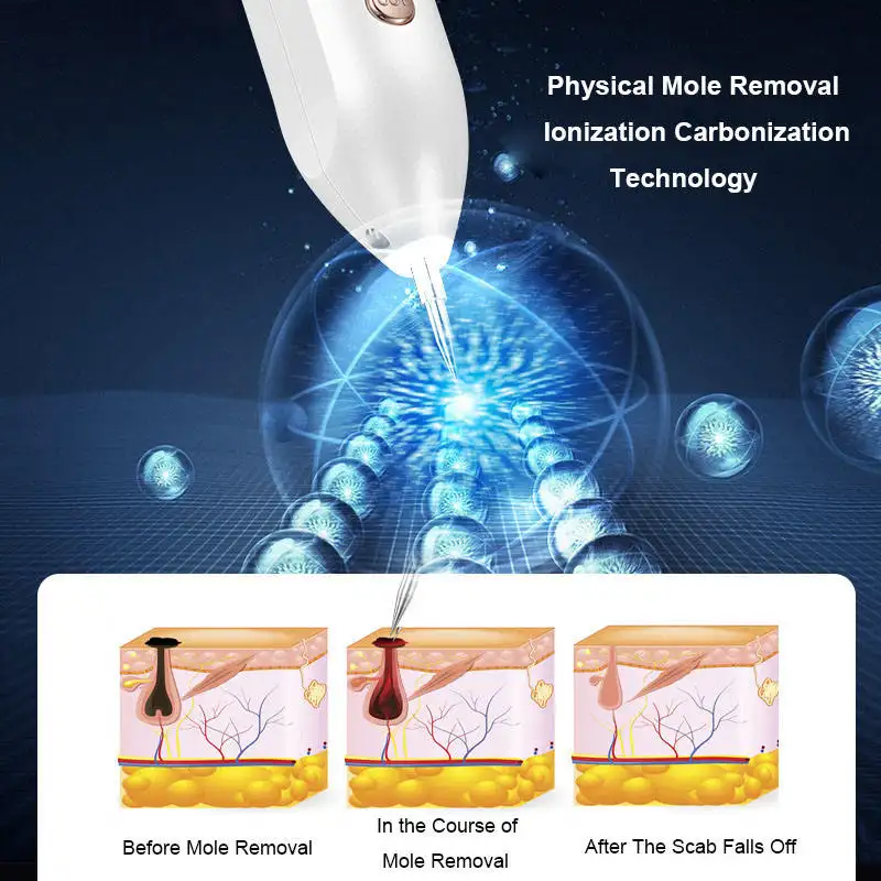 High Quality Facial Laser Tattoo Acne Scar Removal Point Fibroblast Plamere Plasma Spot Dot Mole Freckle Pen Plasmapen
