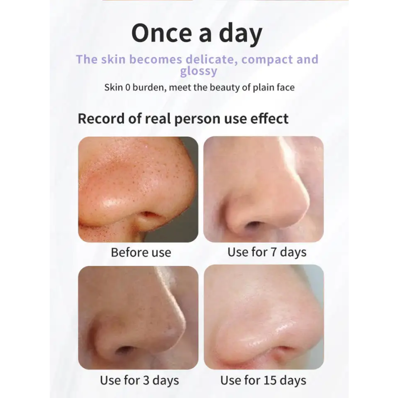 Facial Blackhead Remover Electric Acne Cleaner Most Popular Black Point Vacuum Cleaner Tool Black Spots Pore Cleaner Machine