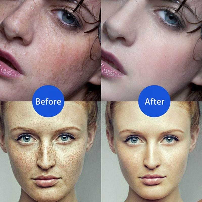 Electric Plasma Pen Freckle Remove Pen Mole Wart Spot Remover Blue Light Beauty Home Use Device Portable Rechargeable