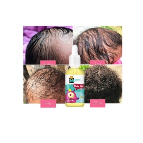 Baby Hair Oil Supplier - Fast Absorbing Formula for Black Kids Hair