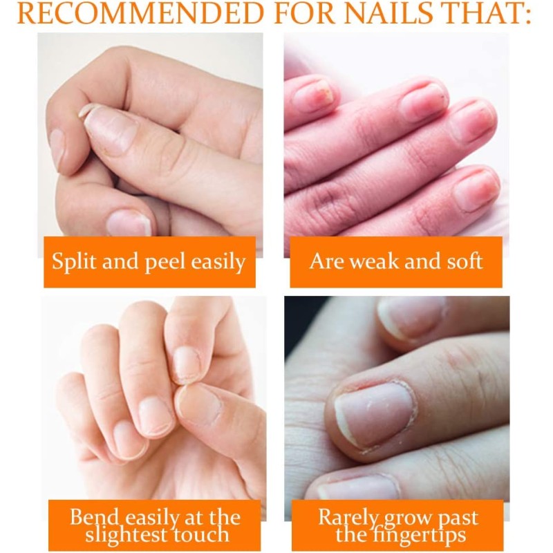 Nail Gel Manufacturer - Fungal Treatment Whitening Removal Gel