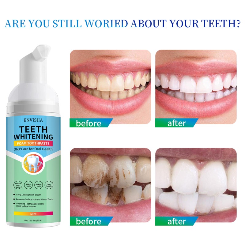 Tooth Whitening Supplier - Deep Cleaning White Teeth Mousse