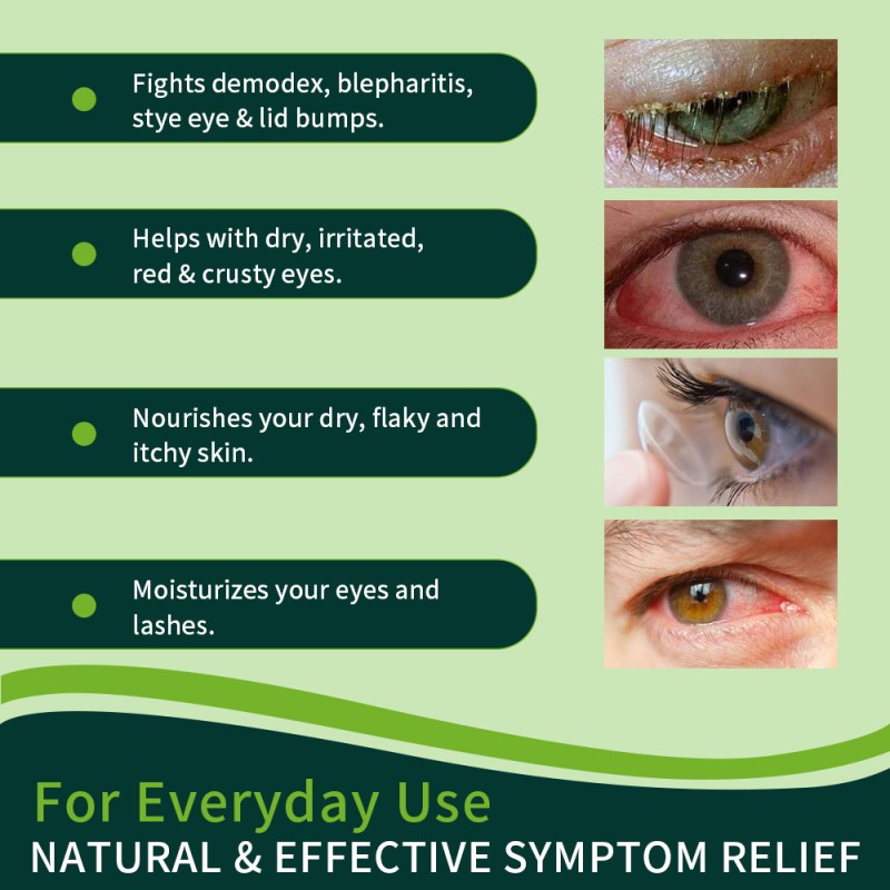 Lash Cleanser Manufacturer - Fast Acting Non Irritating Shampoo