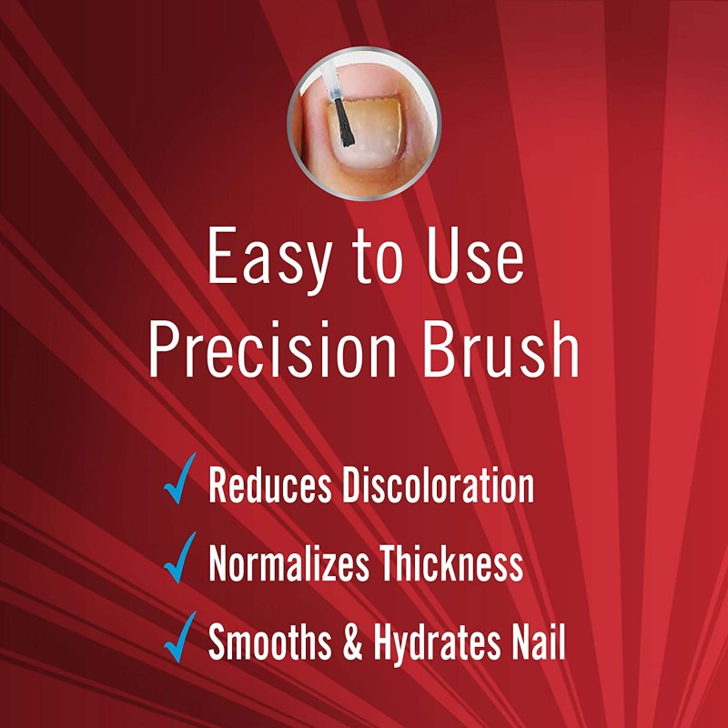 Nail Treatment Oil Supplier - Toe Nail Fungus Removal Oil