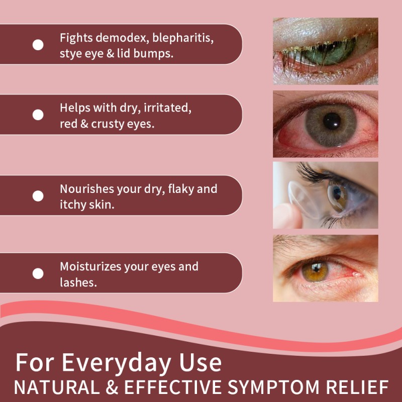 Eye Cream Supplier - Natural Organic Dark Circles Treatment