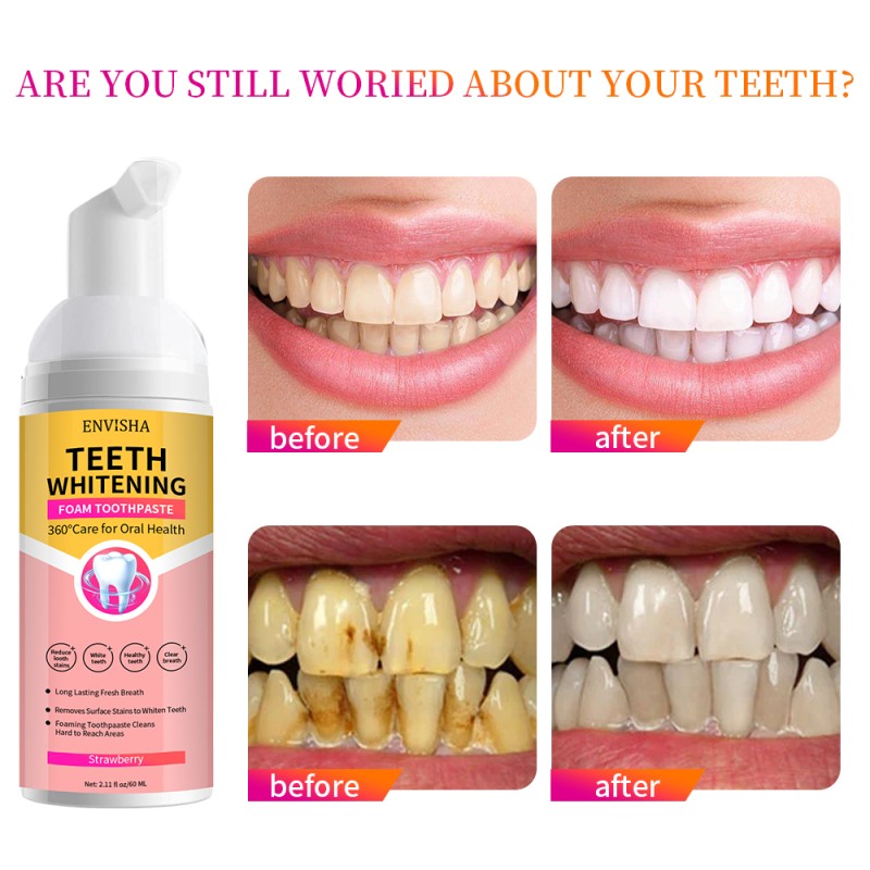 Foam Toothpaste Factory - Private Label Mint Teeth Whitening Foam