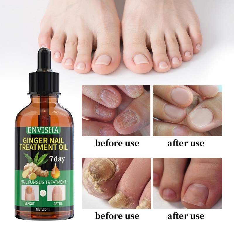 Spot Remover Supplier - Organic Body Underarm Whitening Cream