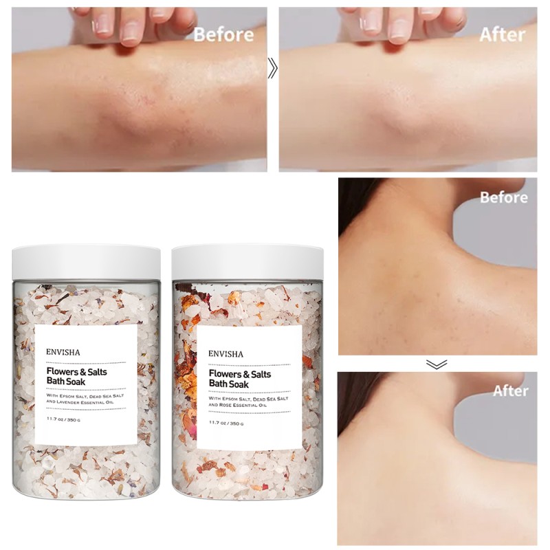 Whitening Soap Supplier - Body Bath Bar Handmade Kojic Soap