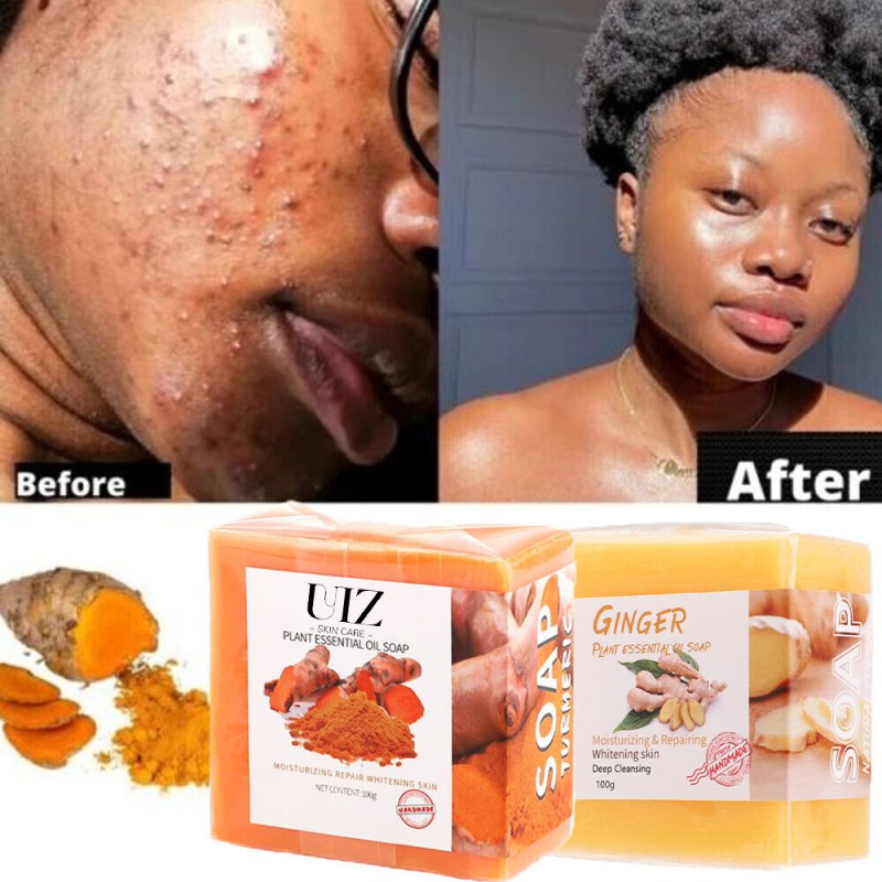 Soap Manufacturer - Natural Essential Oil Ginger Acne Dark Spot