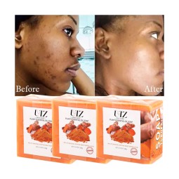 Soap Manufacturer - Natural Essential Oil Ginger Acne Dark Spot