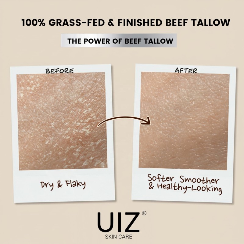 Face Cream Manufacturer - 100% Grass-Fed Beef Tallow Honey