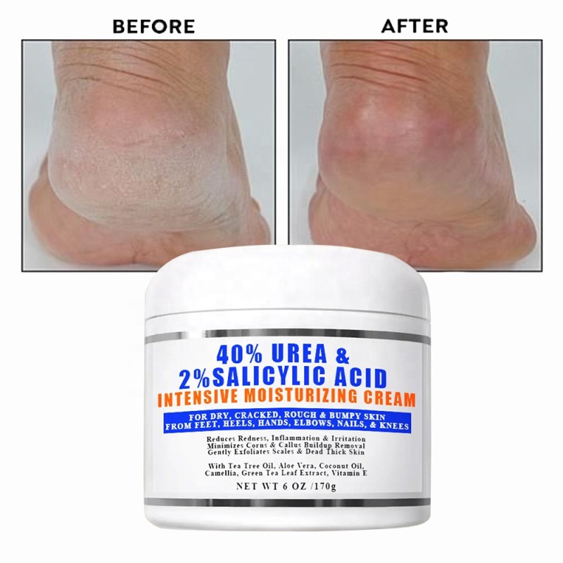 Foot Care Lotion Stick Factory - Urea Softening Moisturizing Dead Skin