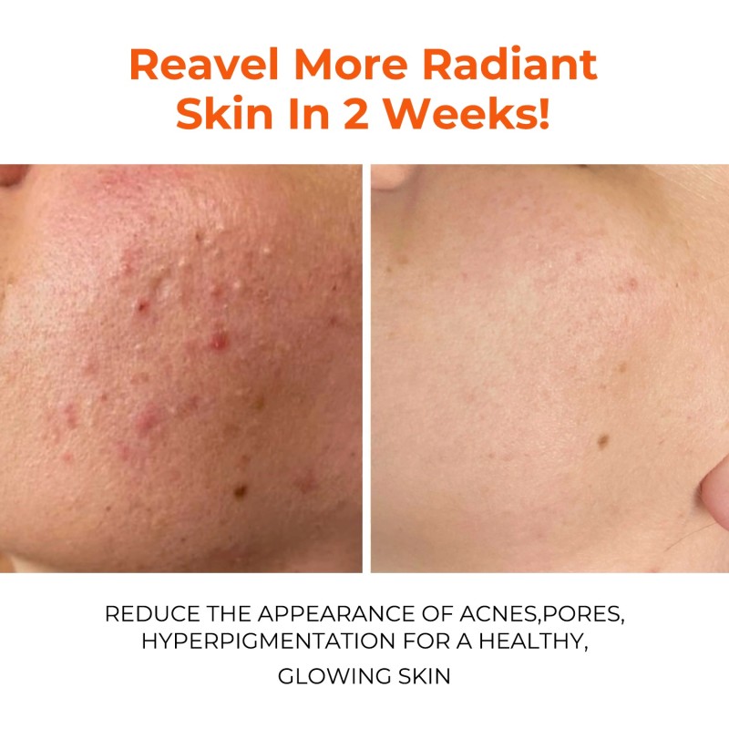 Mud Mask Manufacturer - Turmeric Deep Cleansing Pores Oil Control