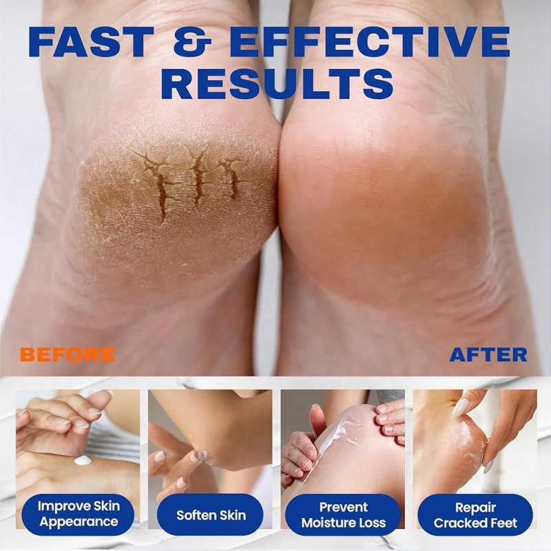 Foot Care Lotion Stick Factory - Urea Softening Moisturizing Dead Skin