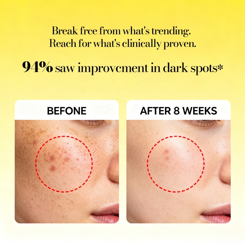 Night Cream Manufacturer - Vitamin C Intense Brightening Anti-Aging