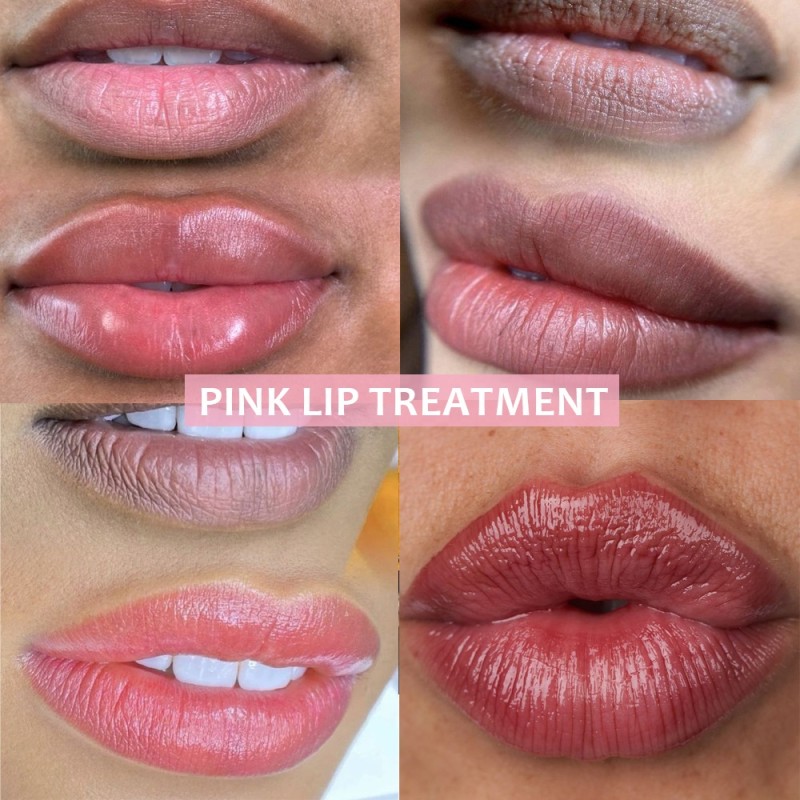 Brightening Lip Balm Manufacturer - Fast Brightening Smoker Hydrating