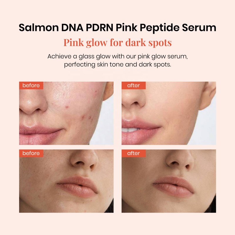 Salmon Serum Factory - Wholesale PDRN Pink Peptide Firming