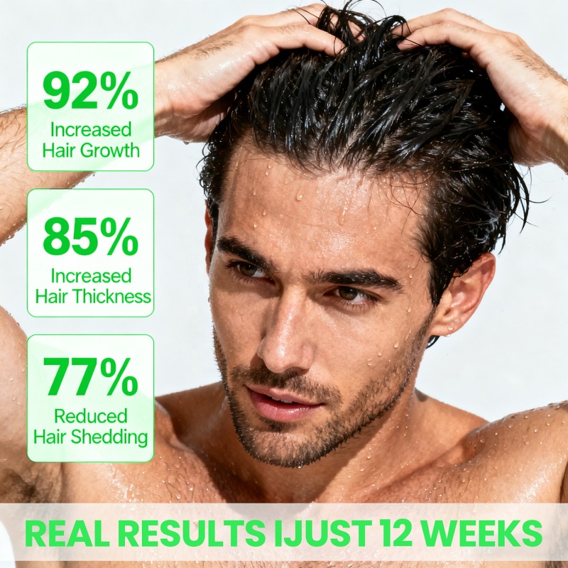 Root Activator Shampoo Manufacturer - Anti-Dandruff Thickening Organic