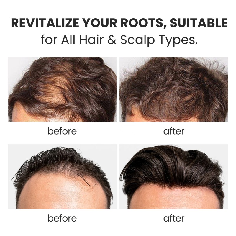 Root Activator Shampoo Manufacturer - Anti-Dandruff Thickening Organic