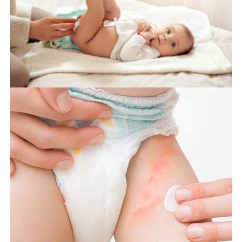Diaper Spray Supplier - 100% Natural Hypochlorous Germs Removal