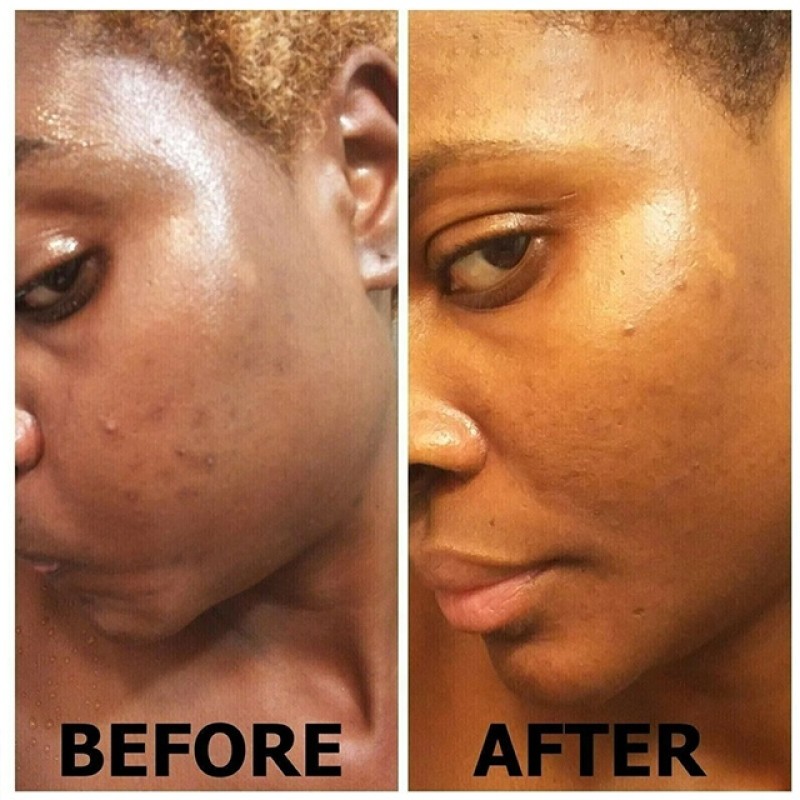 African Black Soap Factory - Handmade Organic Face Body Whitening Soap