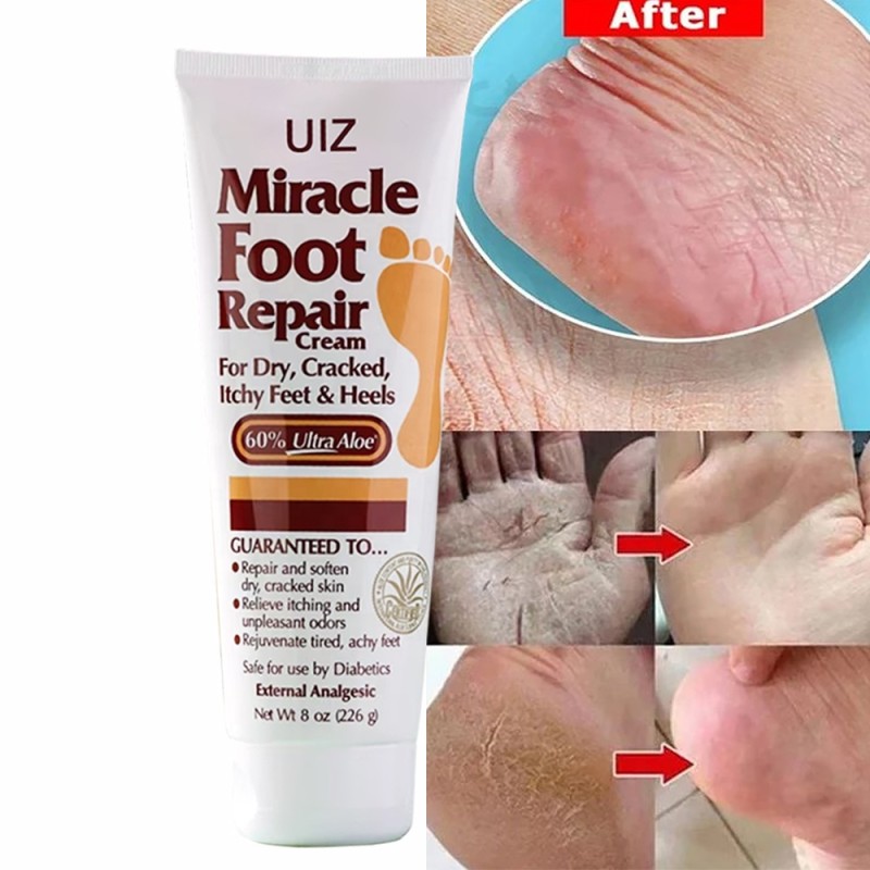 Foot Repair Cream Supplier - 60% Urea Exfoliating Aloe Anti Crack