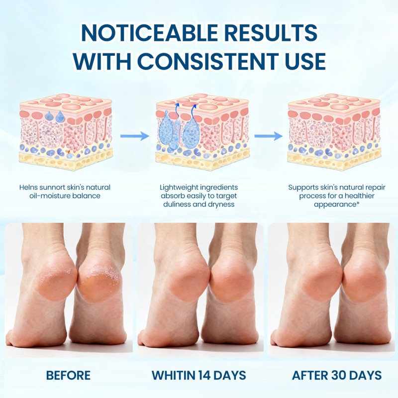 Foot Moisturizer Factory - 40g 60% Urea 2% Salicylic Acid