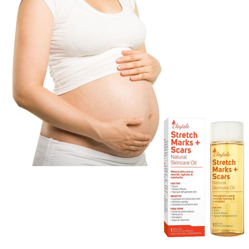 Stretch Mark Oil Manufacturer - OEM/ODM Private Label Natural Plant Regenerating Body