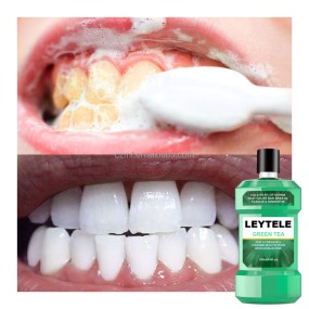 Teeth Whitening Mouthwash Manufacturer - OEM/ODM Private Label Natural Organic