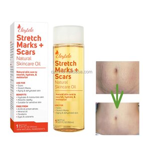 Stretch Mark Removal Oil Manufacturer - OEM/ODM Wholesale Private Label Natural Smooth
