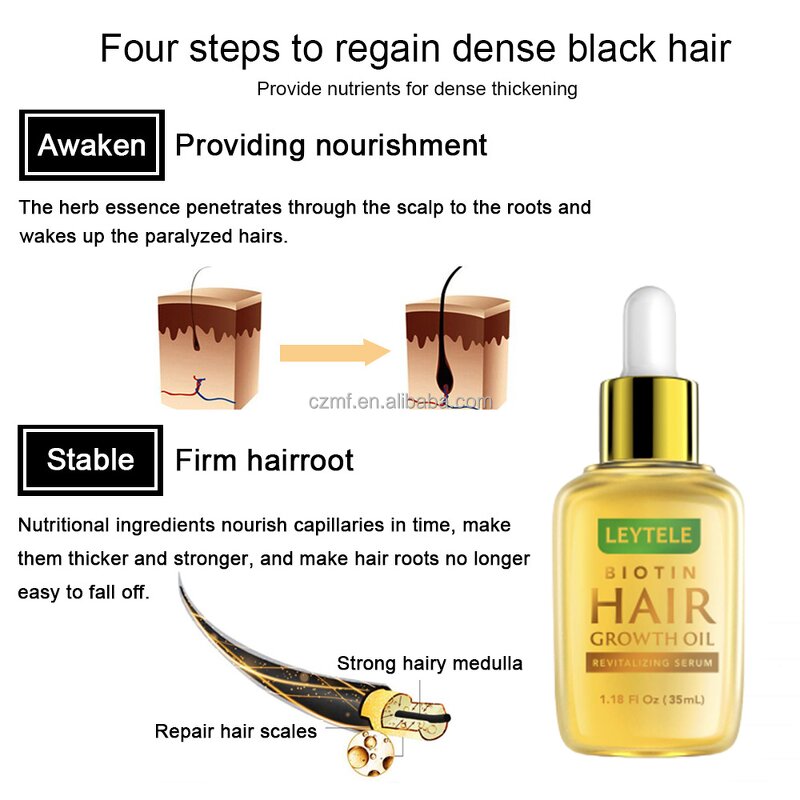 Hair Growth Oil Serum Manufacturer - OEM/ODM Wholesale Private Label Herbal Anti Loss