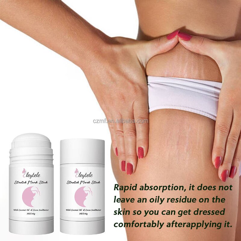 Stretch Mark Stick Manufacturer - OEM/ODM Women Care Pregnancy Acne Scar Prevention