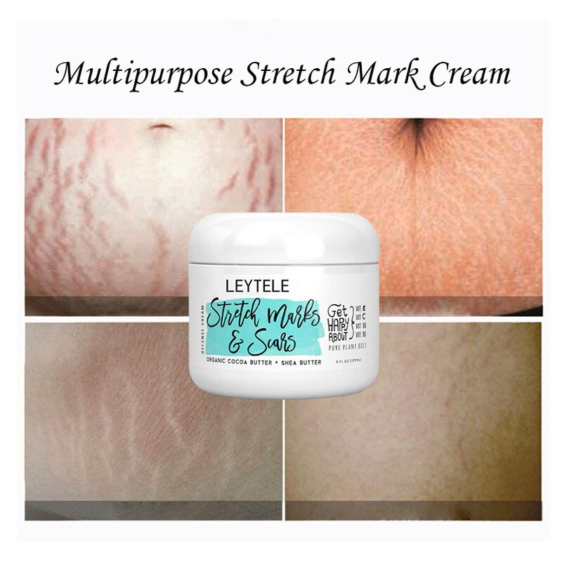 Stretch Mark Oil Cream Manufacturer - OEM/ODM Private Label Best Natural Body Care