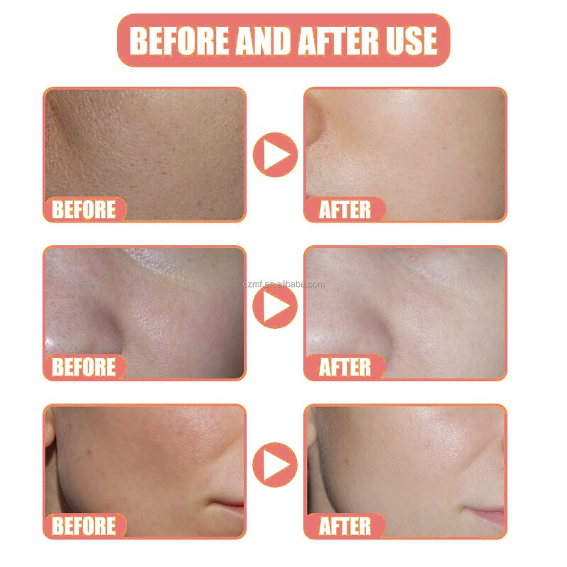 Whitening Vitamin C Serum Manufacturer - OEM/ODM Wholesale Private Label Pure