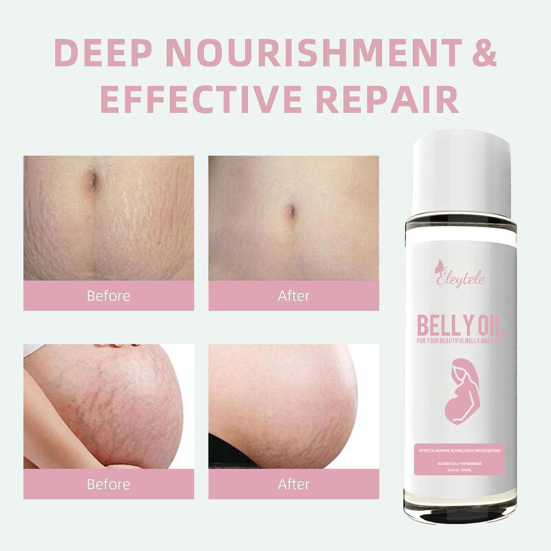 Slimming Patch Manufacturer - OEM/ODM Wholesale Organic Fat Burning Herbal Belly Button