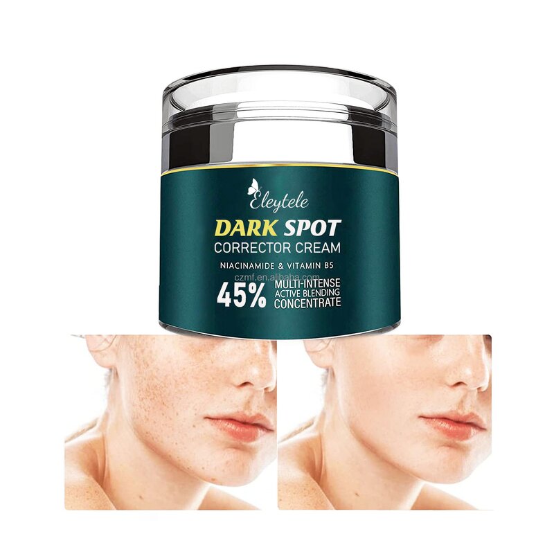 Dark Spot Remover Cream Manufacturer - OEM/ODM Natural Pimples Melasma Bleaching