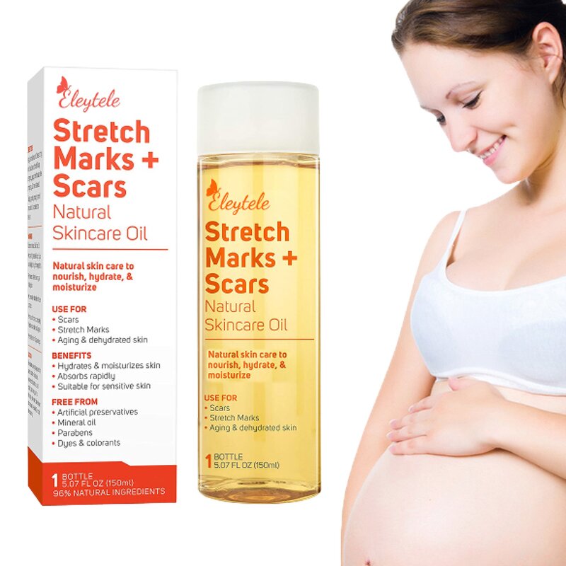 Stretch Mark Oil Manufacturer - OEM/ODM Private Label Natural Plant Regenerating Body