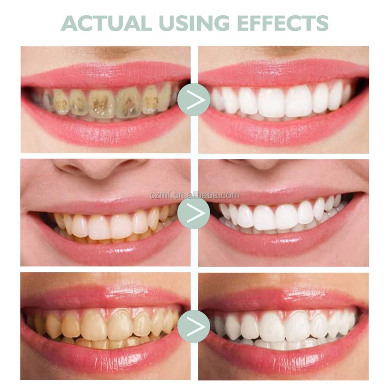 Dog Mouth Wash Manufacturer - OEM/ODM Private Label OEM Healthy Relieve Organic