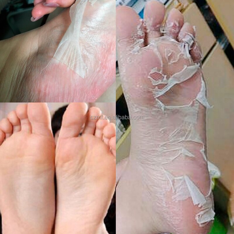 Foot Mask Manufacturer - OEM/ODM Private Label Feet SPA Exfoliating Collagen