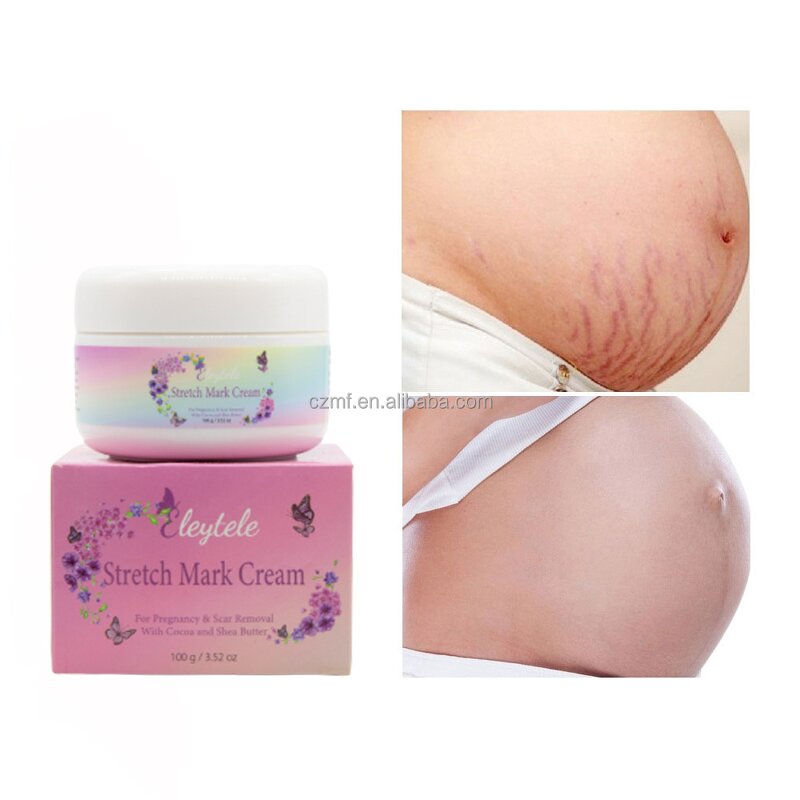 Stretch Mark Cream Manufacturer - OEM/ODM Wholesale Natural Maternity Private Label