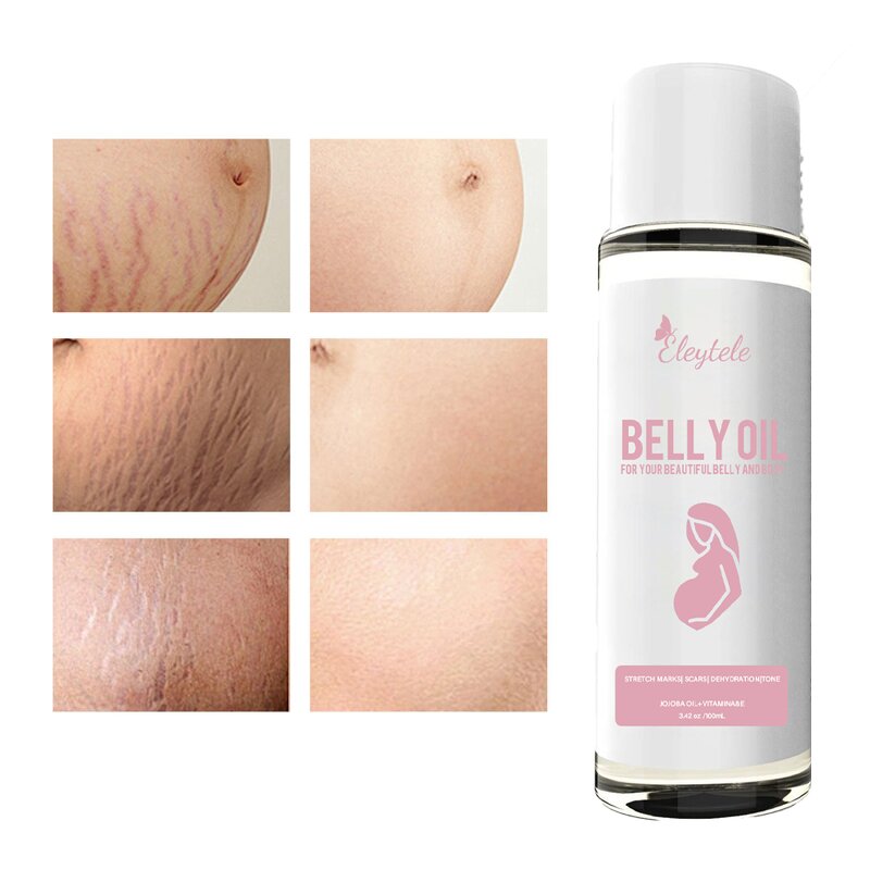 Slimming Patch Manufacturer - OEM/ODM Wholesale Organic Fat Burning Herbal Belly Button