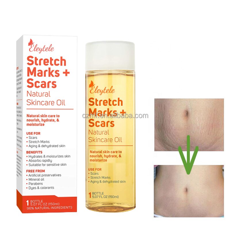 Stretch Mark Oil Manufacturer - OEM/ODM Private Label Best Natural Organic Skincare