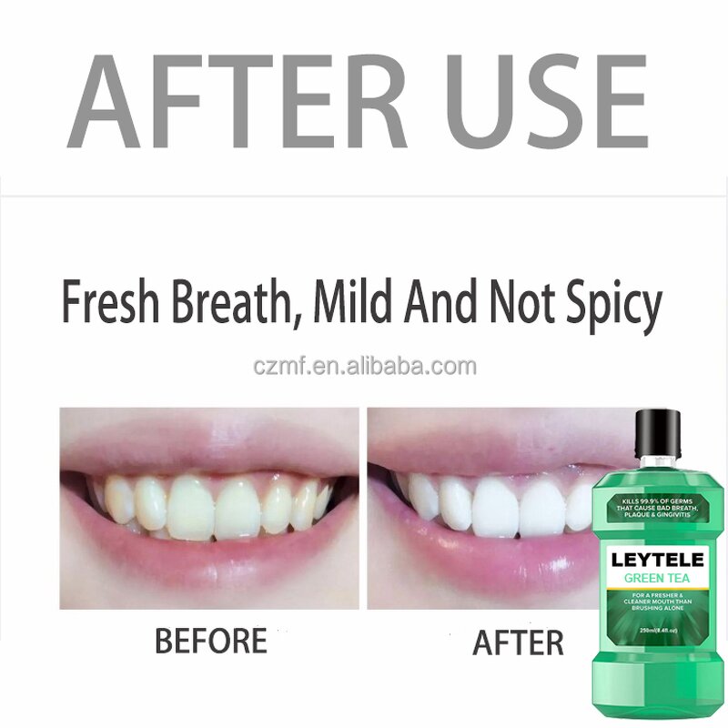 Teeth Whitening Mouthwash Manufacturer - OEM/ODM Private Label Natural Organic